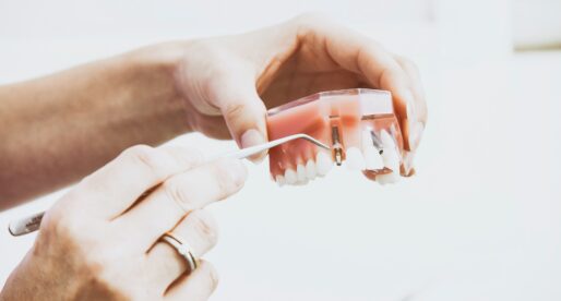 The Advantages Of Biological Dentistry